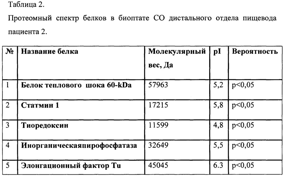 Способ диагностики пищевода барретта у больных с осложненным течением гастроэзофагеальной рефлюксной болезни (патент 2655807)