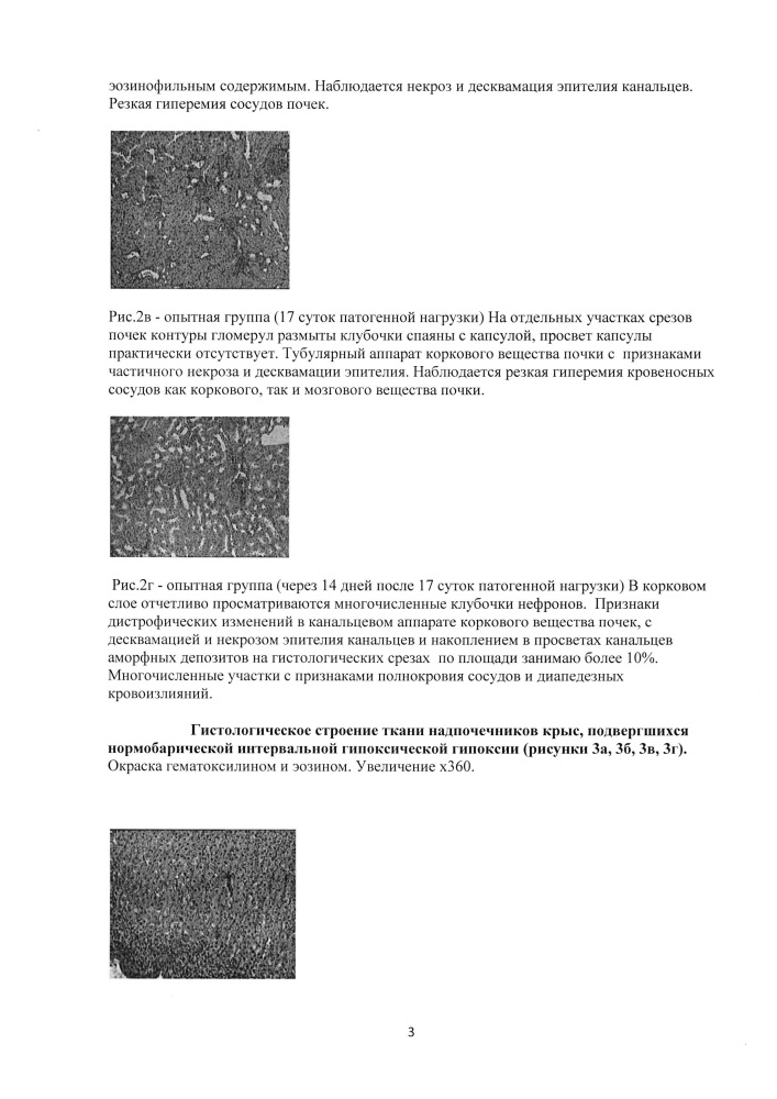 Способ моделирования вторичного постгипоксического иммунодефицита по дисрегуляторному типу с транзиторной недостаточностью cd4-позитивных лимфоцитов (патент 2609281)
