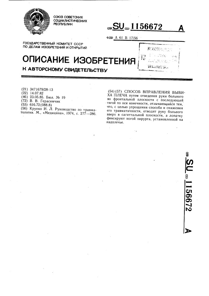 Способ вправления вывиха плеча (патент 1156672)