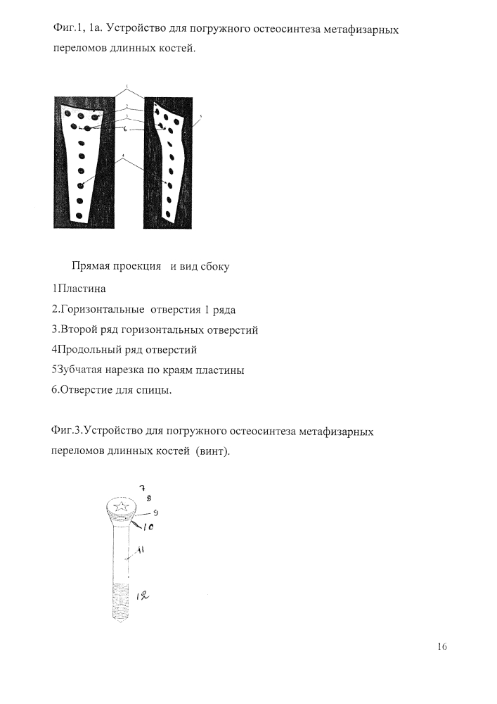 Устройство и способ блокируемого погружного остеосинтеза мыщелковых переломов длинных костей (патент 2632508)