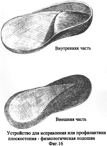 Способ и устройство для исправления дефектов стопы (патент 2301039)