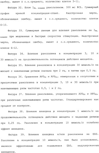 Применение ранолазина для изготовления лекарственного средства для лечения аритмий (патент 2325161)