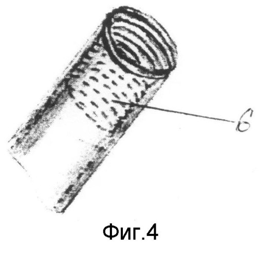 Устройство для интрамедуллярного остеосинтеза (патент 2502489)