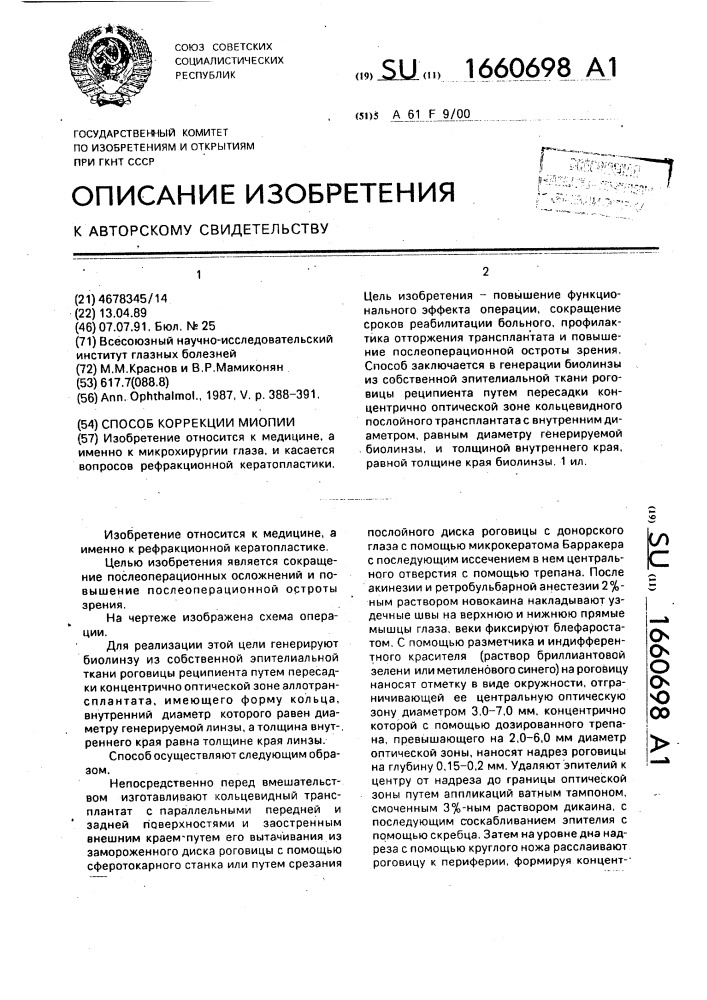 Способ коррекции миопии (патент 1660698)