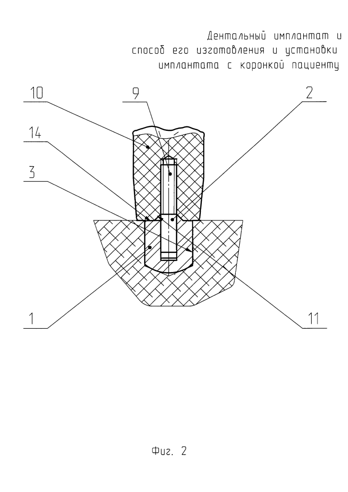 Дентальный имплантат и способ его изготовления (патент 2624169)