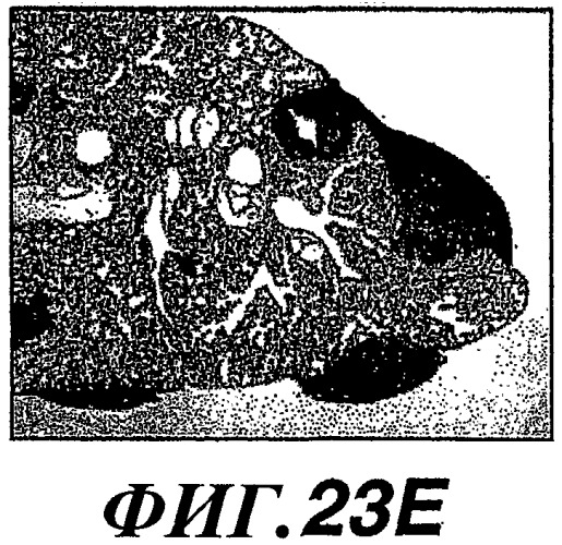 Способы и композиции для модуляции и обнаружения активности wisp (патент 2412201)