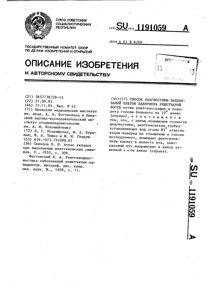 Способ диагностики заболеваний клеток лабиринта решетчатой кости (патент 1191059)