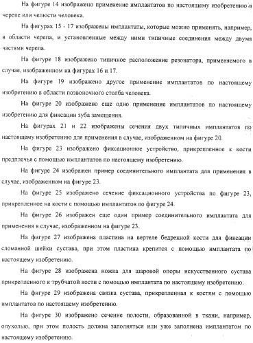 Имплантаты для создания соединений с тканями, в частности со скелетом, а также устройство и способ имплантации (патент 2314768)