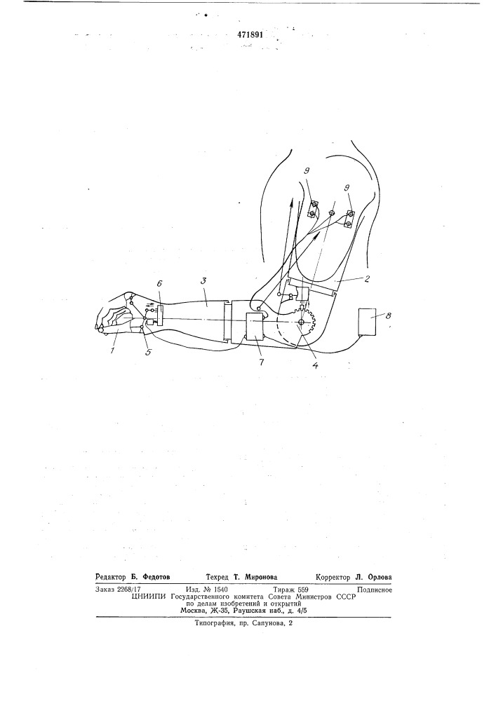 Активный протез плеча (патент 471891)