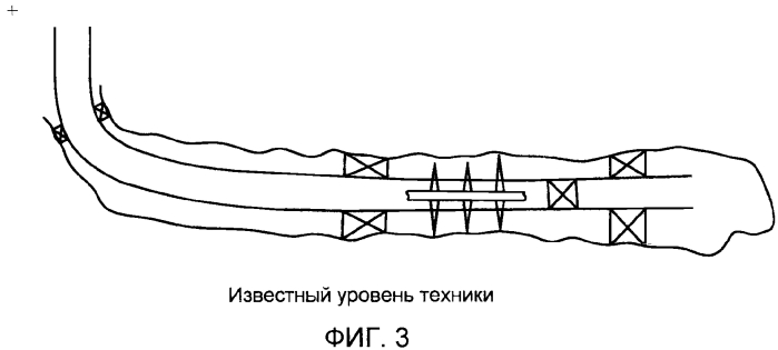Состоящее из сегментов складывающееся гнездо шара, обеспечивающее извлечение шара (патент 2572879)