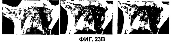 Конъюгаты rgd-пептидов и фотосенсибилизаторов порфирина или (бактерио)хлорофилла и их применение (патент 2450018)