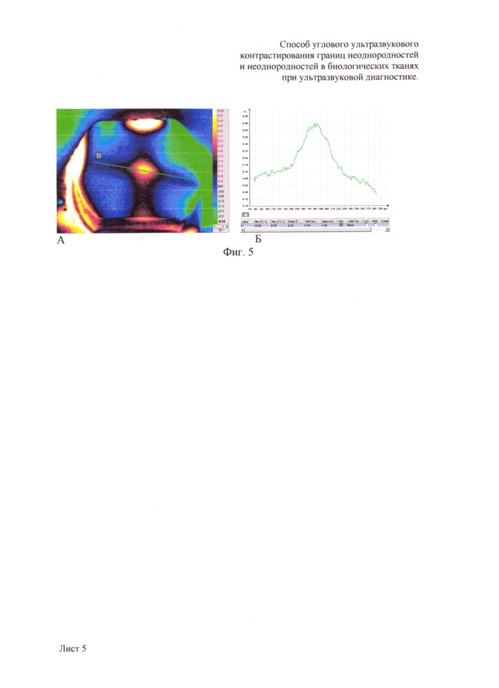 Способ углового ультразвукового контрастирования границ неоднородностей и неоднородностей в биологических тканях при ультразвуковой диагностике (патент 2648880)