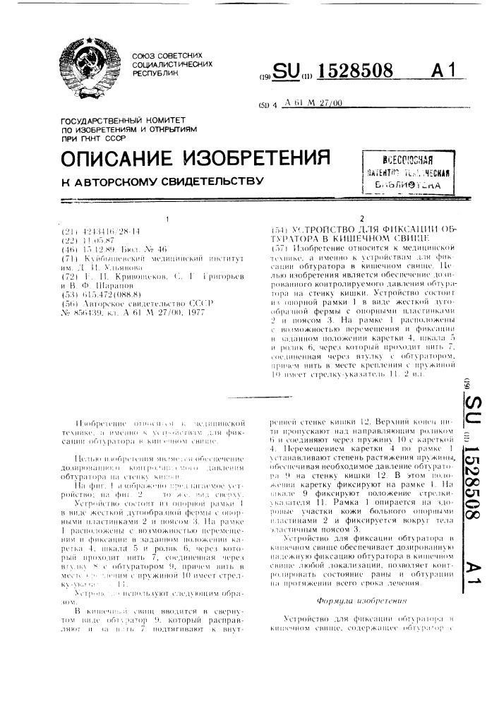 Устройство для фиксации обтуратора в кишечном свище (патент 1528508)