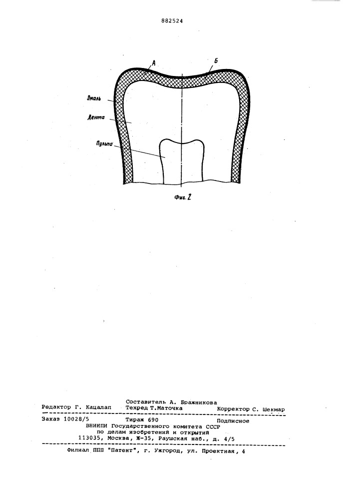 Состав для лечения гиперестезии твердых тканей зуба (патент 882524)