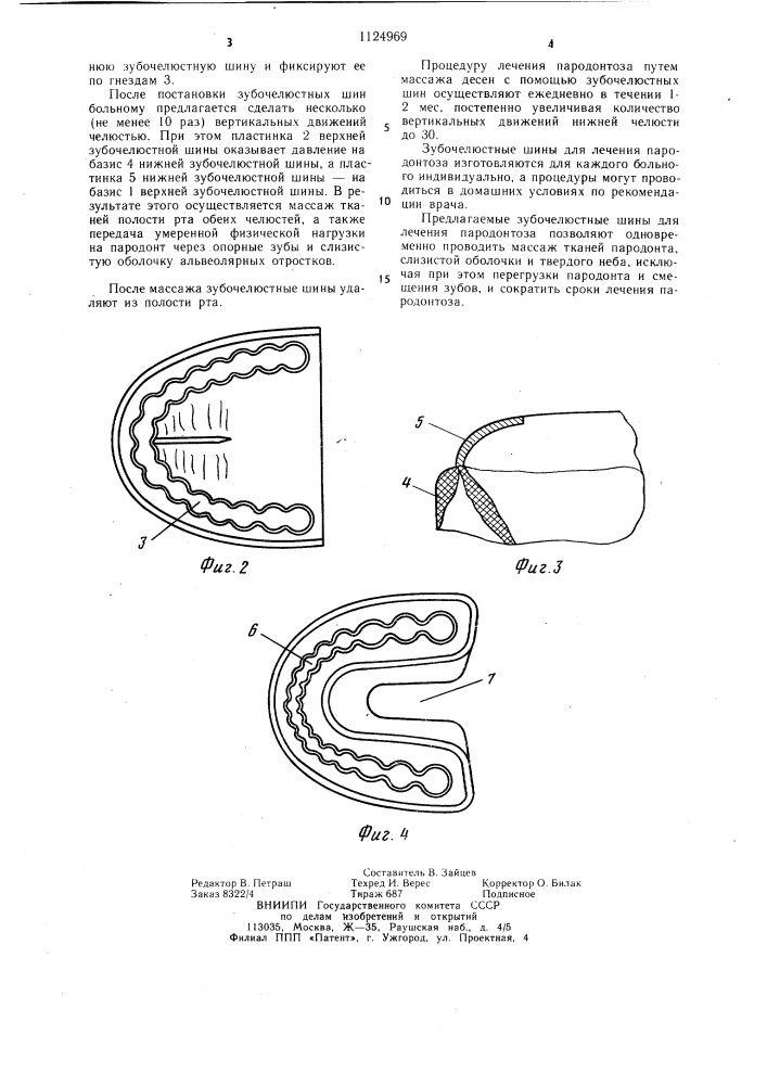 Зубочелюстные шины для лечения пародонтоза (патент 1124969)