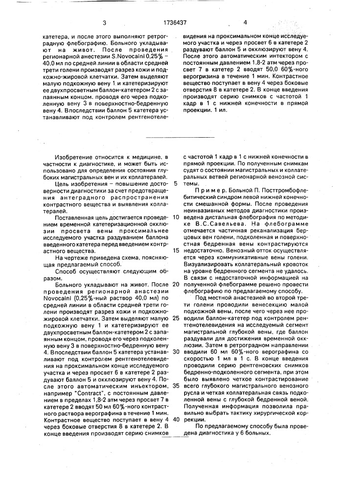 Способ катетеризационной флебографии (патент 1736437)