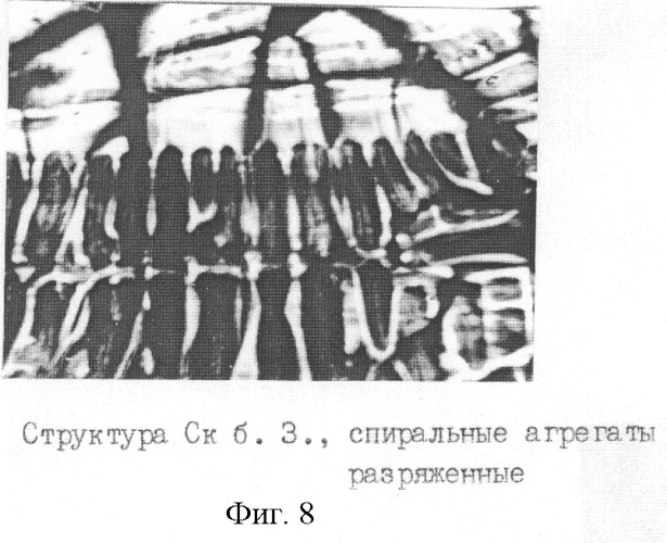 Способ экспресс-диагностики гипер-бета 2-микроглобулинемии (патент 2259565)