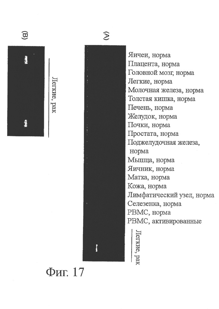 Идентификация опухолеассоциированных антигенов для диагностики и терапии (патент 2644686)