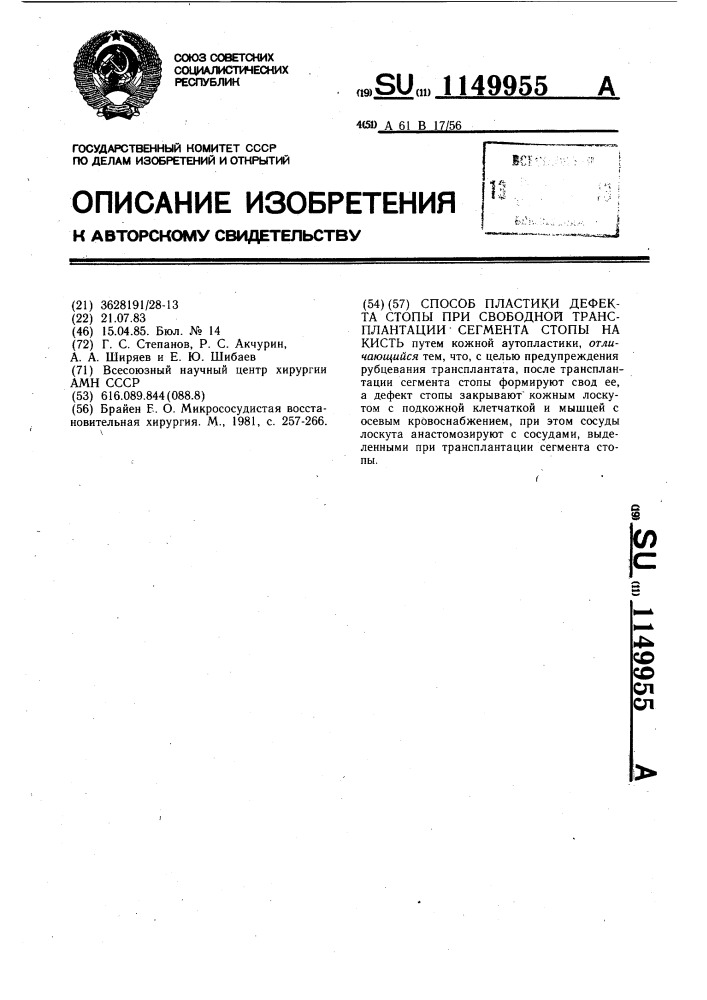 Способ пластики дефекта стопы при свободной трансплантации сегмента стопы на кисть (патент 1149955)