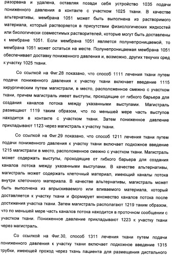 Устройство для лечения путем подкожной подачи пониженного давления с использованием текучей магистрали и связанный с ним способ (патент 2405459)