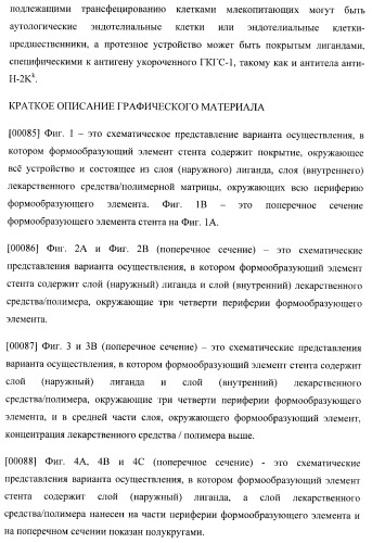 Захват эндотелиальных клеток-предшественников элюирующим лекарственные средства имплантируемым медицинским устройством (патент 2400256)
