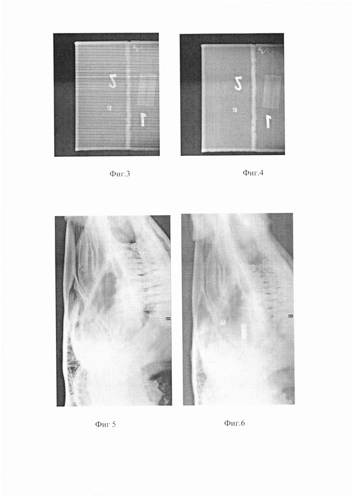 Устройство и способ облучения рентгенолюминофоров рентгеновизиализирующих устройств, работающих как в режиме рентгенографии, так и рентгеноскопии (патент 2623691)