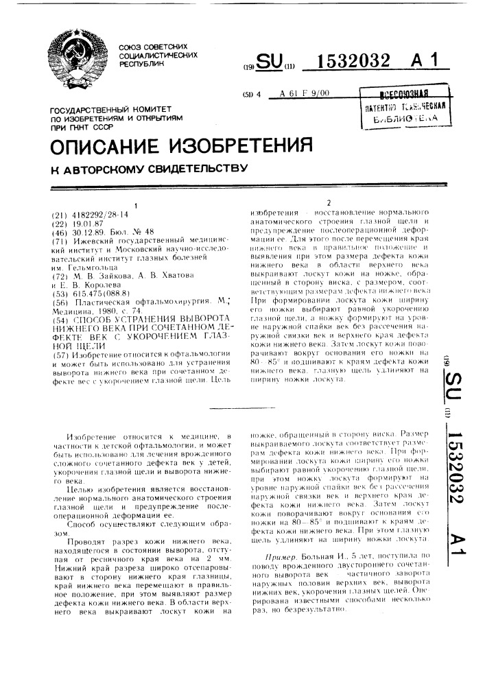 Способ устранения выворота нижнего века при сочетанном дефекте век с укорочением глазной щели (патент 1532032)