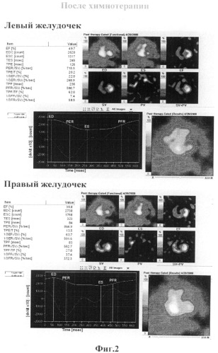 Способ прогнозирования кумулятивной кардиотоксичности химиотерапевтических препаратов (патент 2510240)