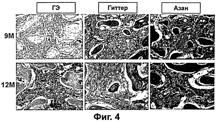 Средство для лечения миелофиброза (патент 2557997)