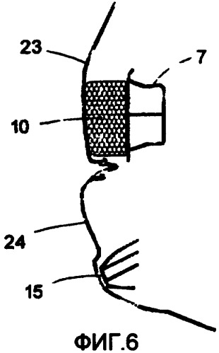 Бамперная система для автомобиля (патент 2392135)