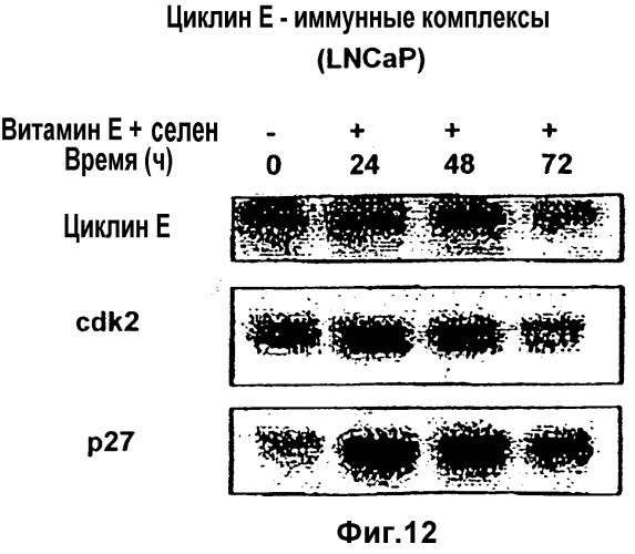 Композиция и способы профилактики и лечения рака предстательной железы человека (патент 2346685)