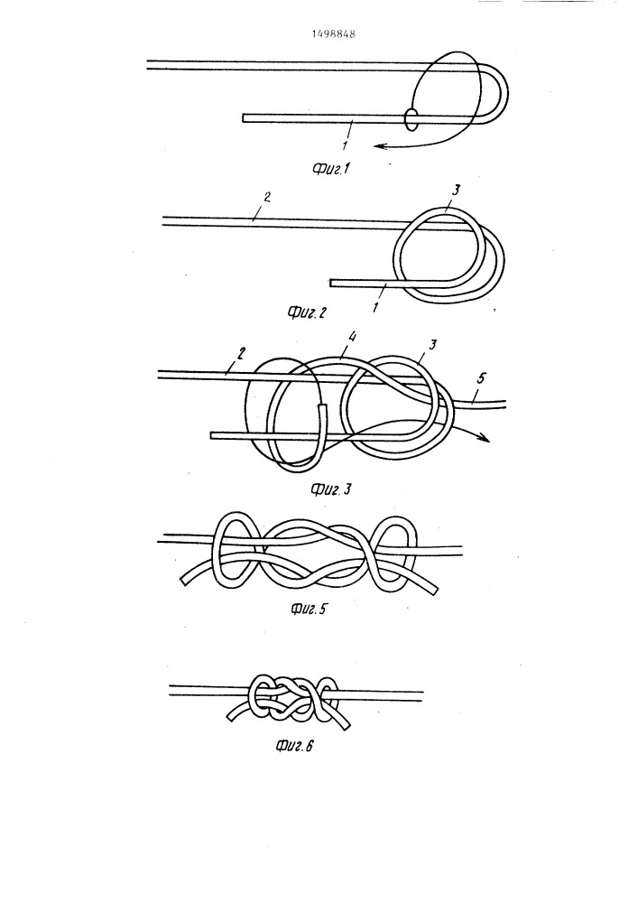 Узел для соединения нитевидных изделий (патент 1498848)