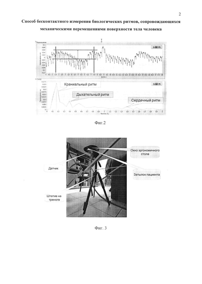 Способ бесконтактного измерения биологических ритмов, сопровождающихся механическими перемещениями поверхности тела человека (патент 2651900)