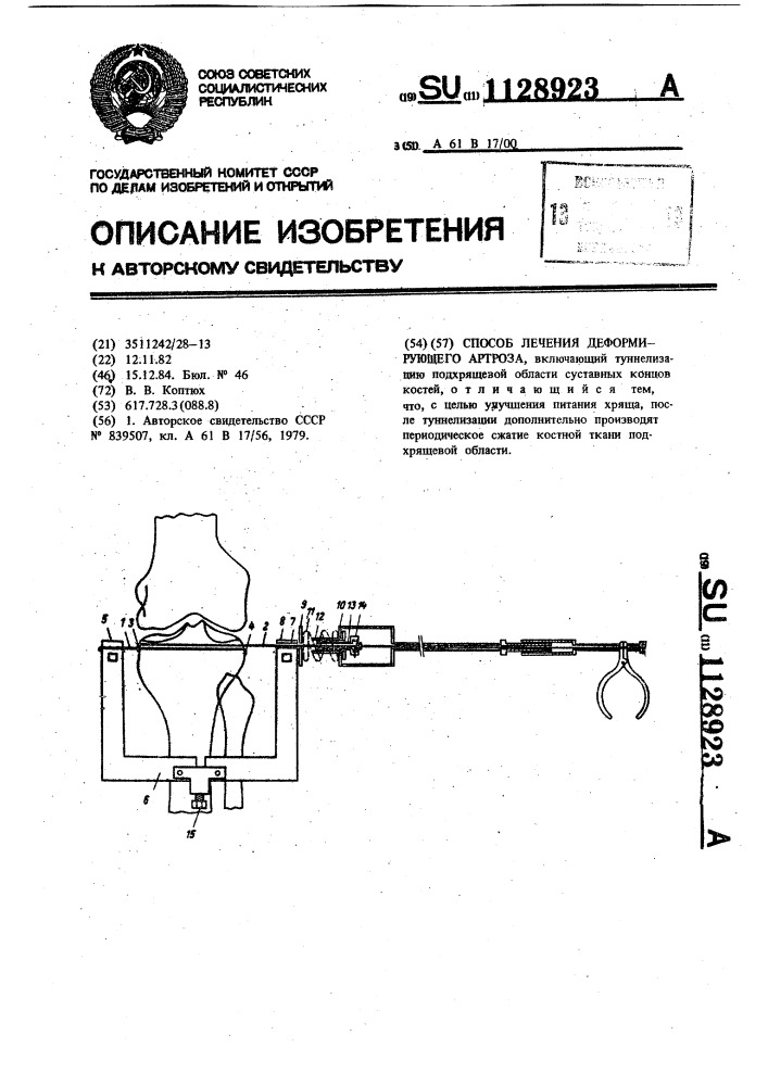 Способ лечения деформирующего артроза (патент 1128923)