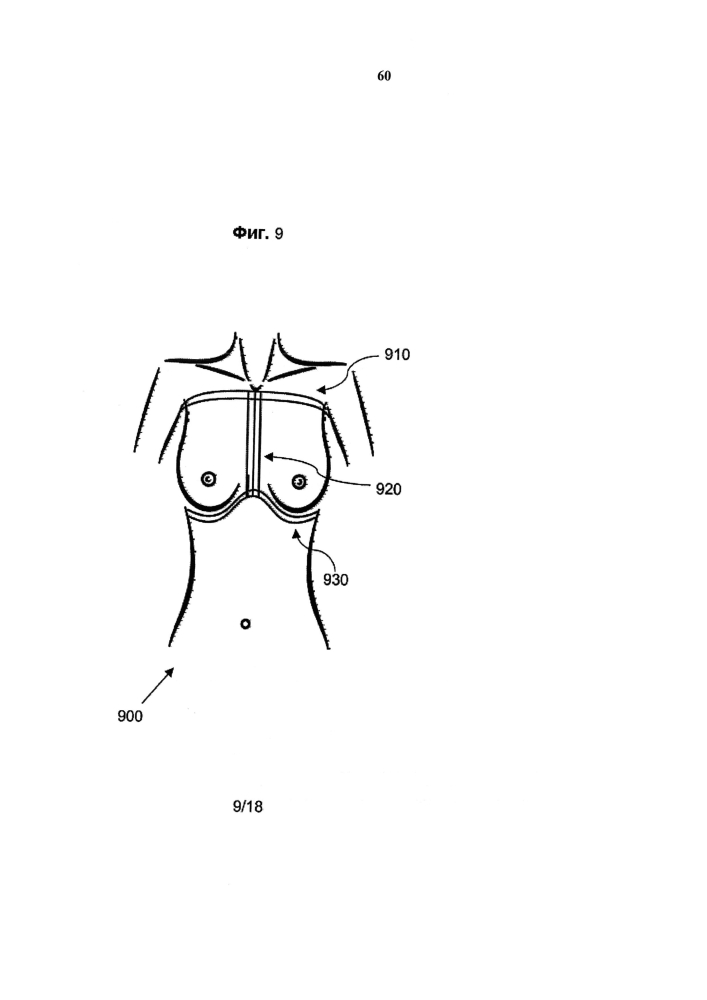 Распознавание анатомических характеристик и размерный анализ объема груди для обеспечения хирургии груди (патент 2604710)