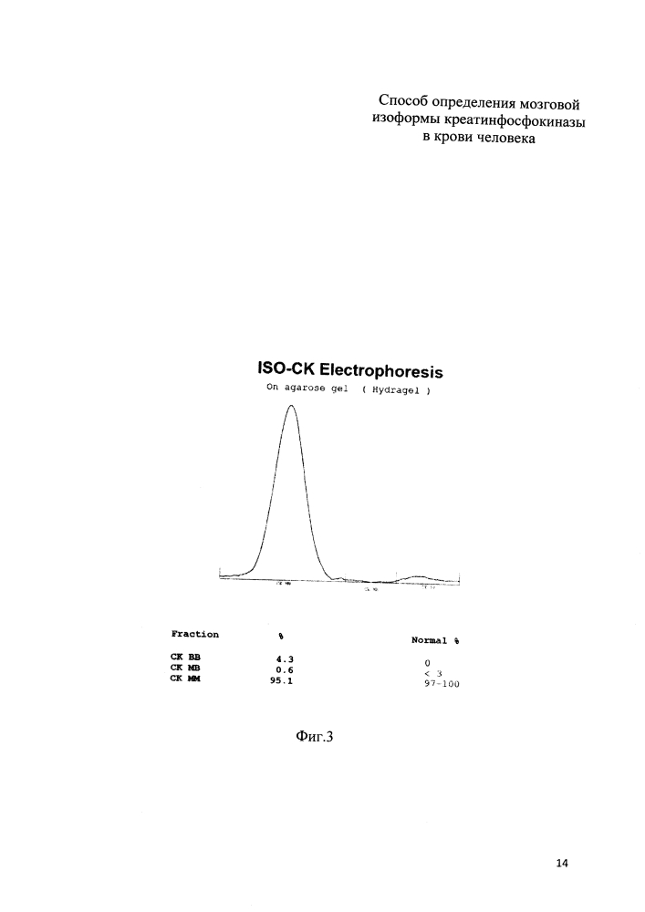 Способ определения мозговой изоформы креатинфосфокиназы в крови человека (патент 2600165)