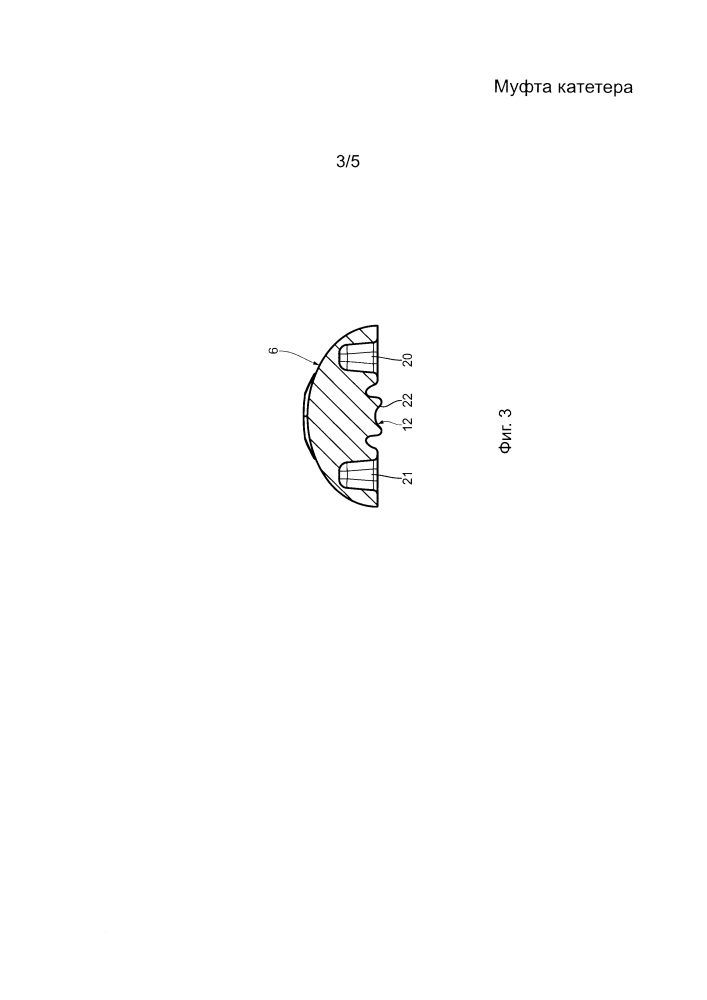 Муфта катетера (патент 2628057)