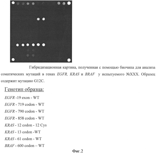 Способ анализа соматических мутаций в генах egfr, kras и braf с использованием lna-блокирующей мультиплексной пцр и последующей гибридизацией с олигонуклеотидным биологическим микрочипом (биочипом) (патент 2552483)