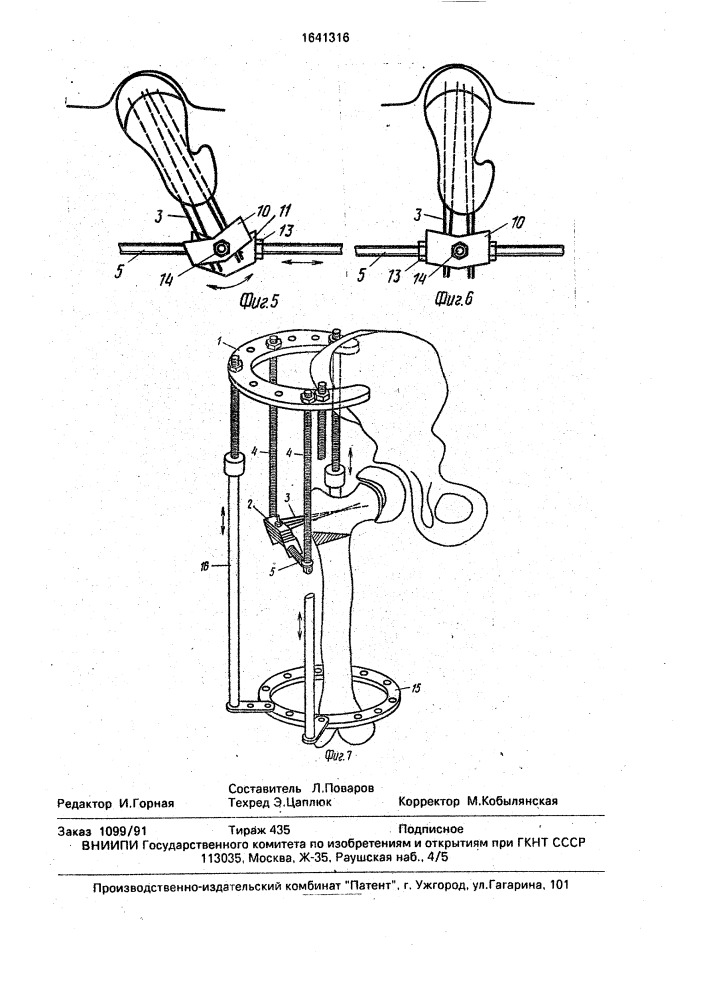 Аппарат для лечения бедренной кости (патент 1641316)