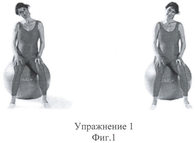 Способ подготовки к родам и послеродовому периоду беременных женщин групп риска на санаторном этапе (патент 2389464)