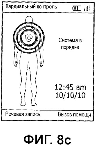 Система контроля экг с конфигурируемыми пределами включения сигналов тревоги (патент 2499550)