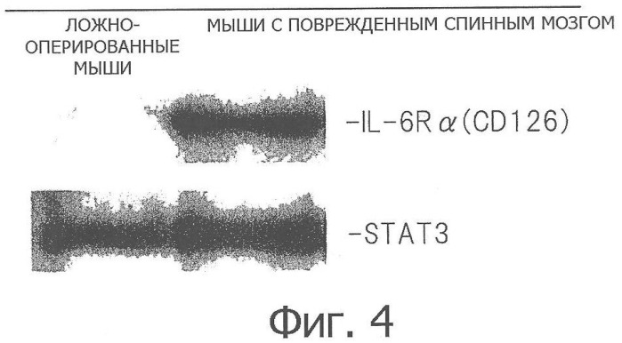 Терапевтическое средство при повреждении спинного мозга, включающее антагонист интерлейкина-6 (патент 2358761)