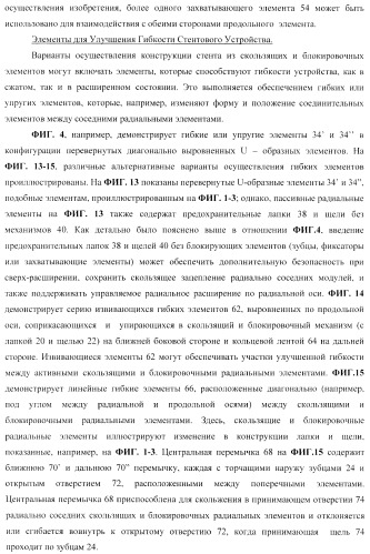 Стент из скользящих и блокирующих элементов (патент 2429801)