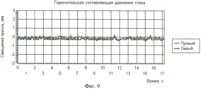 Способ подавления нистагма глаз движущимися полосами (патент 2447865)