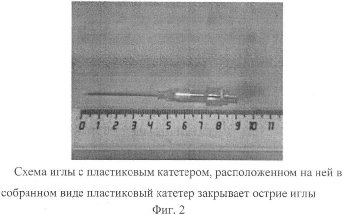 Способ проводниковой анестезии (патент 2426563)