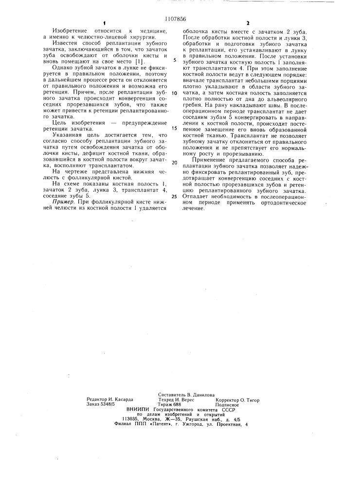 Способ реплантации зубного зачатка (патент 1107856)