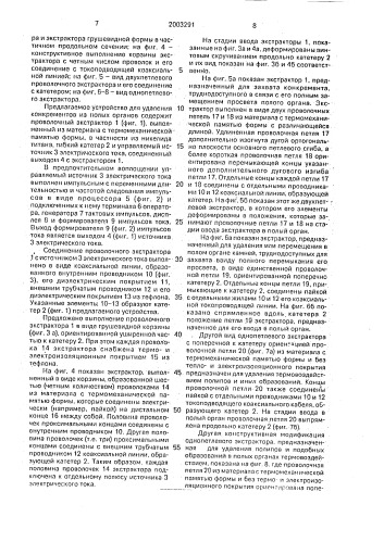 Устройство для удаления конкрементов из полых органов (патент 2003291)