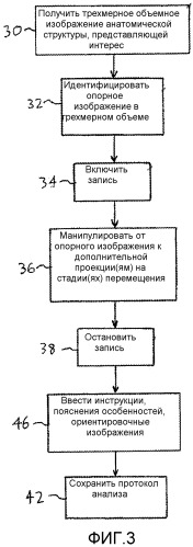 Создание стандартизованных протоколов для анализа данных трехмерной эхограммы (патент 2514112)