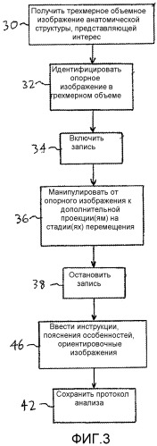 Создание стандартизованных протоколов для анализа данных трехмерной эхограммы (патент 2514112)