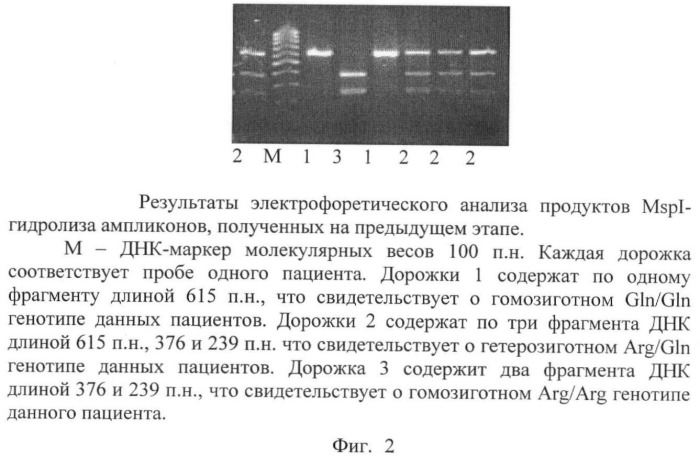 Способ определения предрасположенности человека к развитию агрессивных неходжкинских лимфом (патент 2373862)